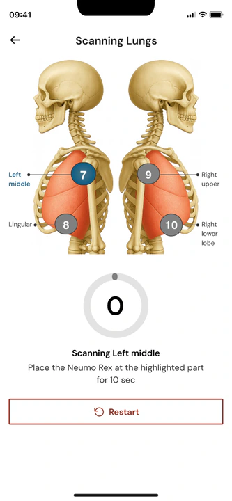 Stethaim: Guided lung scan screen